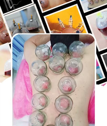 Medical Cupping Center Saham/مركز الحجامة صحم - Saham - +968 9193 2821