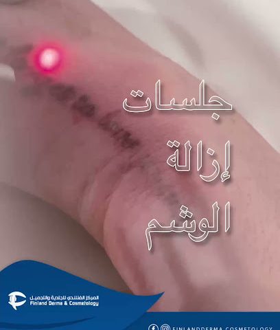 Finland Derma & Cosmetology & Dental - Muscat -